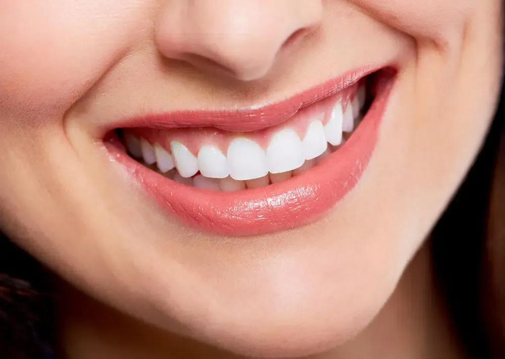 Best Smile Makeover in Pimple Saudagar Best Smile Makeover in Pimple Saudagar