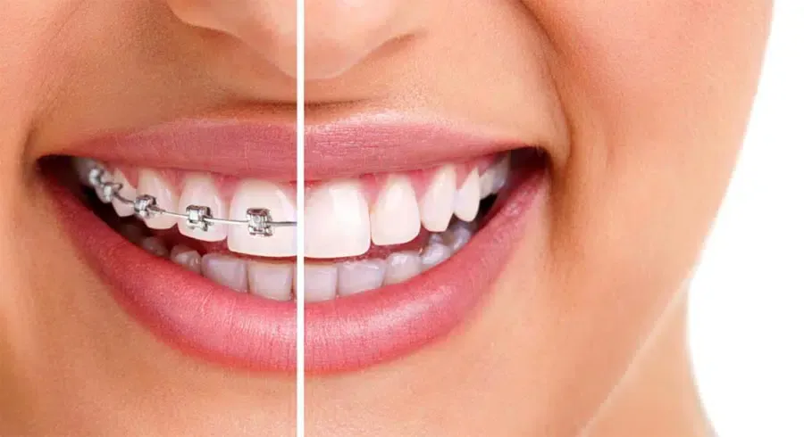 Best Orthodontist Near Me Best Orthodontist Near Me