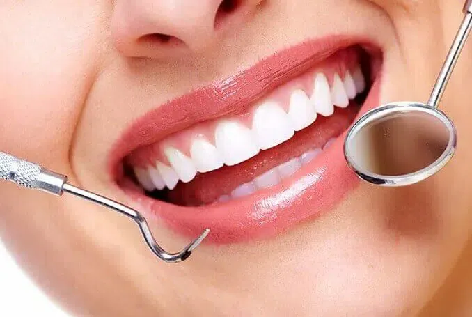 Is Professional Teeth Whitening Worth It