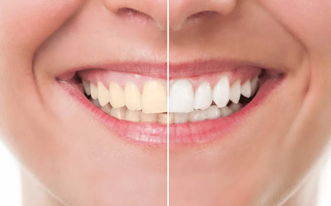 Cosmetic Dentistry: Enhancing Your Smile with the Help of a Dentist