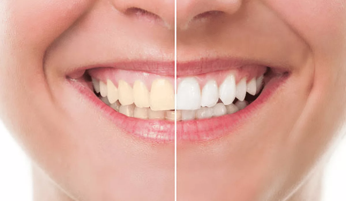 Cosmetic Dentistry: Enhancing Your Smile with the Help of a Dentist