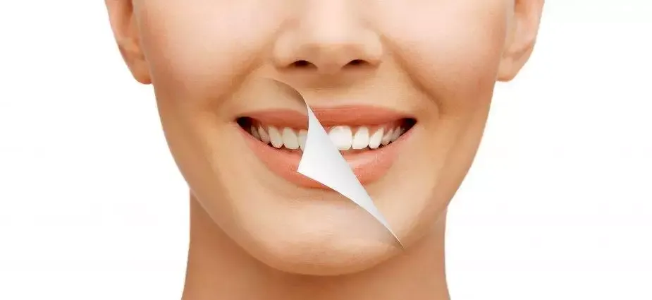 Cosmetic Dentistry: Enhancing Your Smile with Options like Teeth Whitening and Veneers