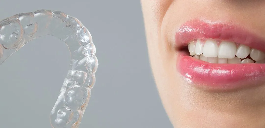 Braces for Adults in Pune – It’s Never Too Late to Straighten Your Smile!