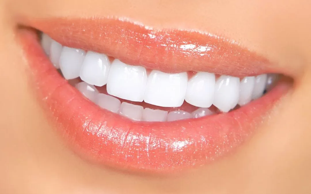 The Truth About Teeth Whitening: Safe Methods That Work